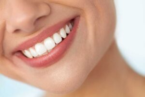 A close-up of a person smiling and showing white, evenly shaped teeth in a bright, indoor setting.